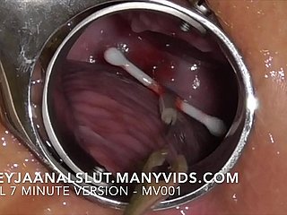 Amatör Freyjaanalslut: IUD'unu Çıkarma - Freyja'nın serviksinden çekerek, onu bir daha verimli hale getiriyor - manyvidlerde tam sürüm