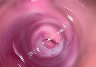Kamera jauh di dalam vagina krim remaja mia