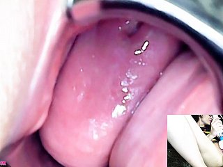 adalynnx-内視鏡鏡鏡Hitachi Vibrator cum